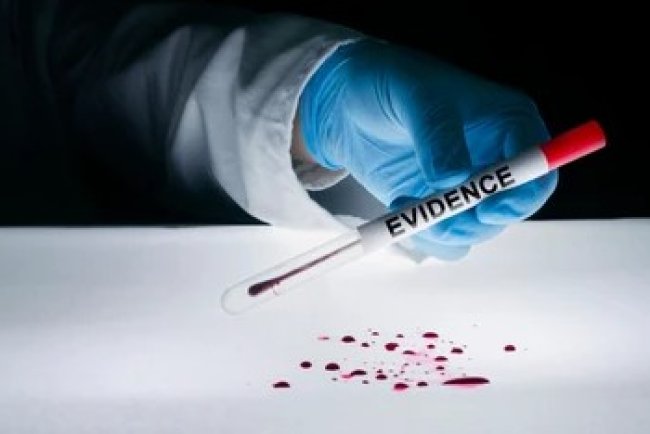 Forensic Hematology: Blood and Plasma Analysis